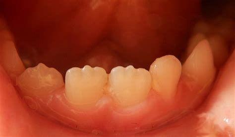 adonitologia wikipedia|Odontología .